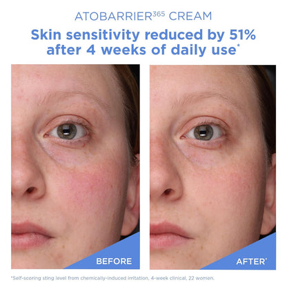 ATOBARRIER365 CREAM